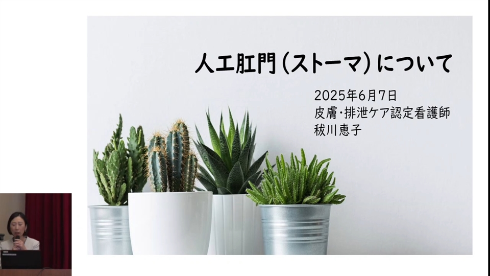 人工肛門（ストーマ）について