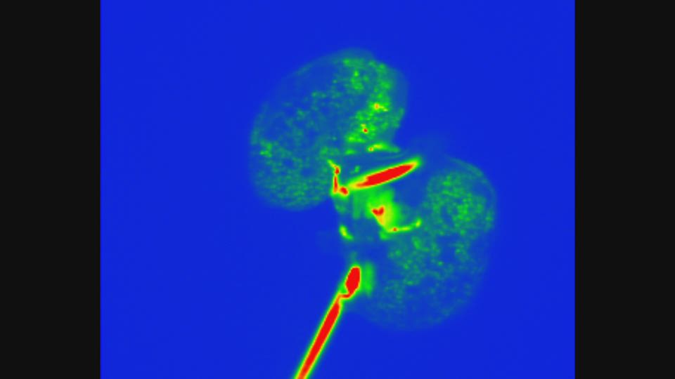 正常ラットの摘出腎臓を用いた形態観察イメージ