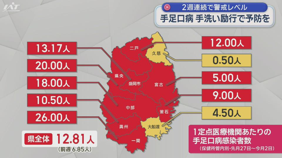 県内でも”警報レベル”で手足口病が流行【岩手】