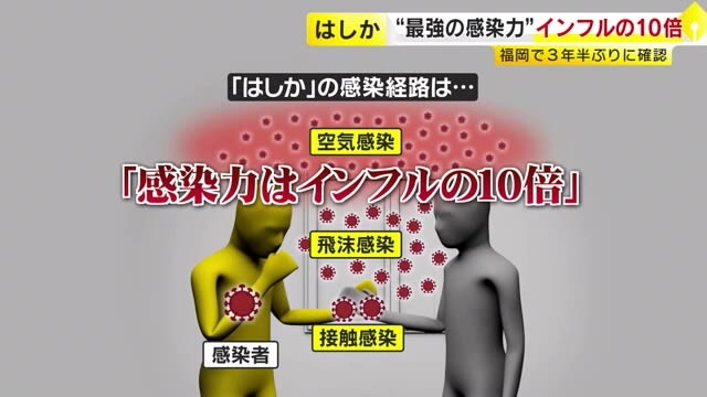 福岡県内で3年半ぶり「はしか」患者確認　インフル10倍の“極めて強い”感染力　妊婦は重篤化のおそれ　ワクチン接種での予防が有効