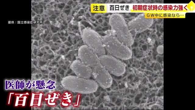 猛威振るう「百日ぜき」…GW後の今の時期が特に注意　一般的な抗菌薬が効かない例も　県内の感染者はすでに去年の4倍超　福岡
