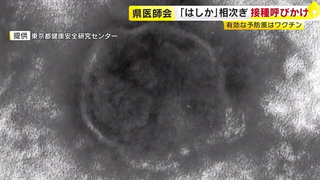 県内で感染相次ぐ「はしか」　県医師会がワクチン接種呼びかけ「成人でも母子手帳など確認して」接種率は目標の95%に届かず　福岡