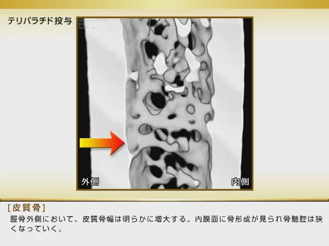 資料ライブラリ テリボン Pharma Digital 旭化成ファーマ医療関係者向けサイト